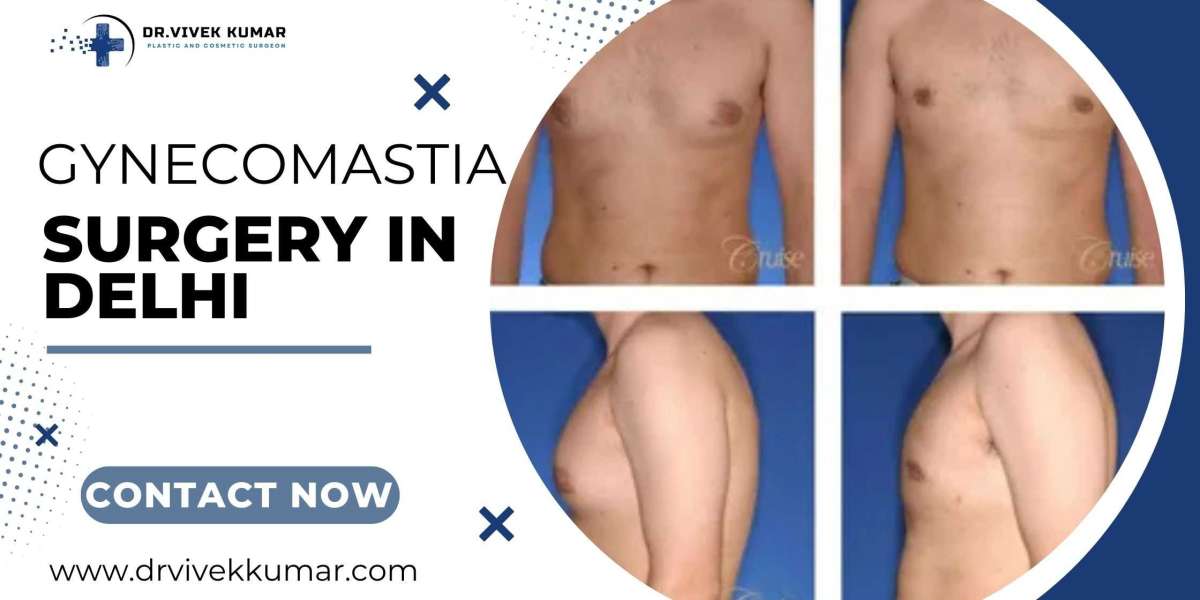 Gynecomastia Surgery in Delhi: Restore Confidence with Expert Care