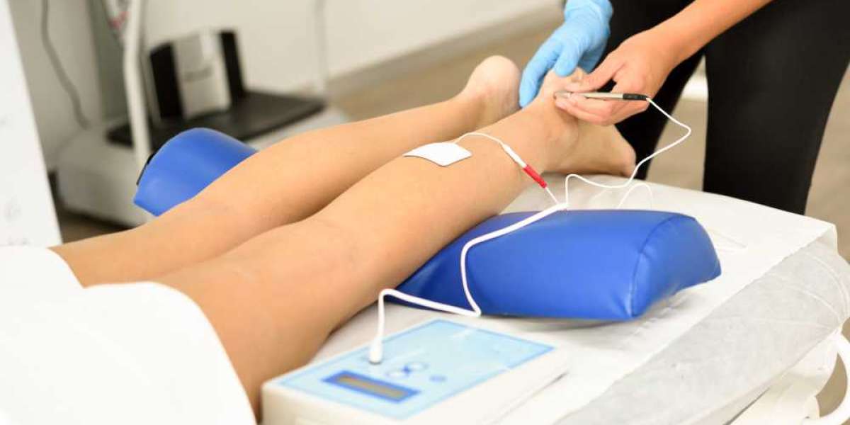 Understanding Sclerotherapy in San Antonio TX