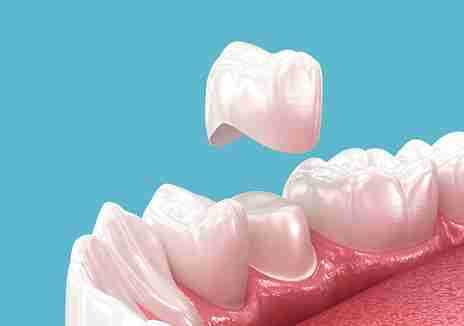 Image Source - Emergency Dentist Bury