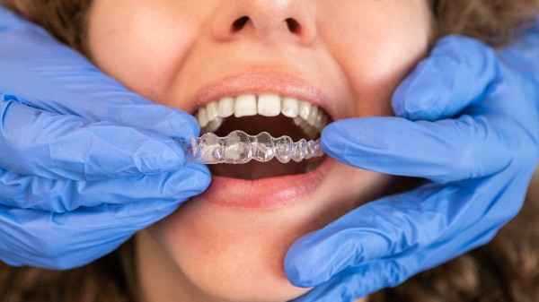 orthodontist Warrington 