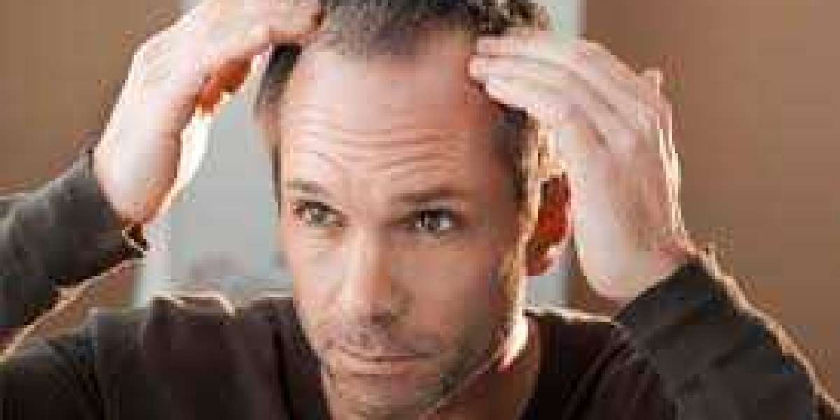 Hair Loss Specialist San Ramon: Expertise and Care