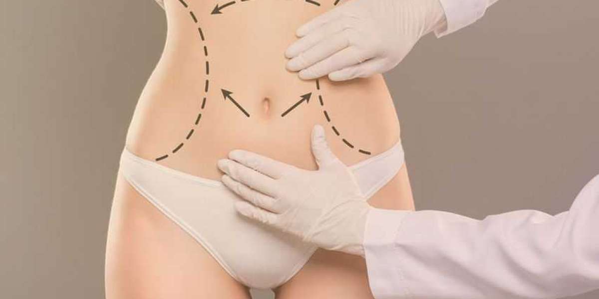 Breast Augmentation in Dubai & Tummy Tuck Surgery – Dr. Hans Plastic Surgeon