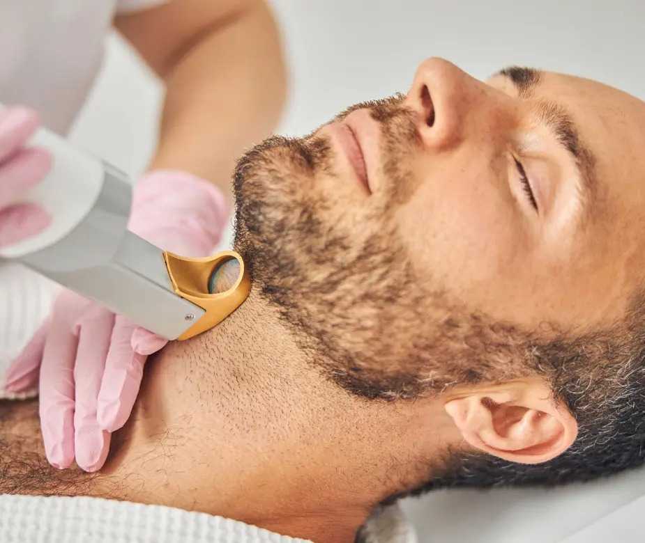 Male Laser Hair Removal
