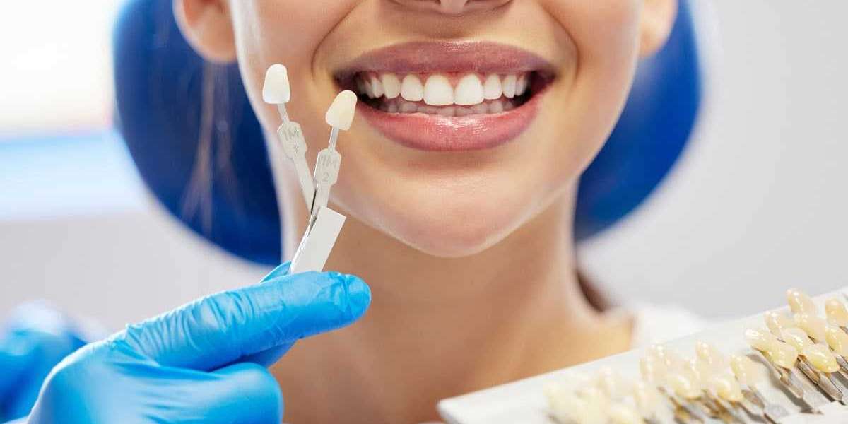 How Do Composite Veneers in Dubai Affect Daily Life?