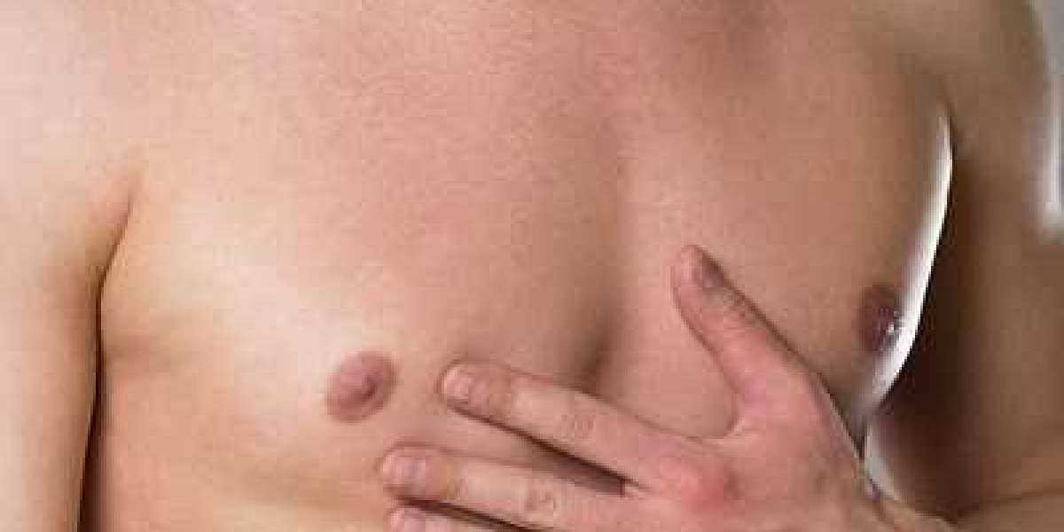 Why It’s Smart to Learn Gynecomastia Surgery Cost in Dubai?