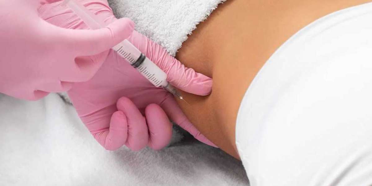 Fat Melting Injections for Men’s Stomach Fat: Real Insights