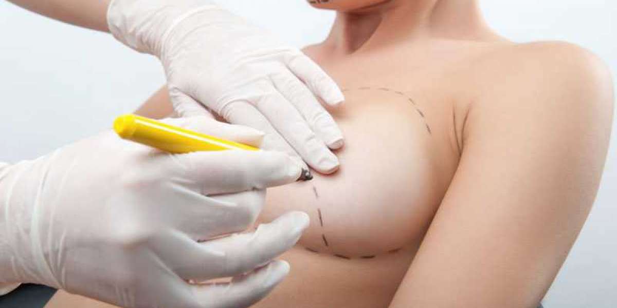 Breast Fillers Injections: Understanding Volume Changes