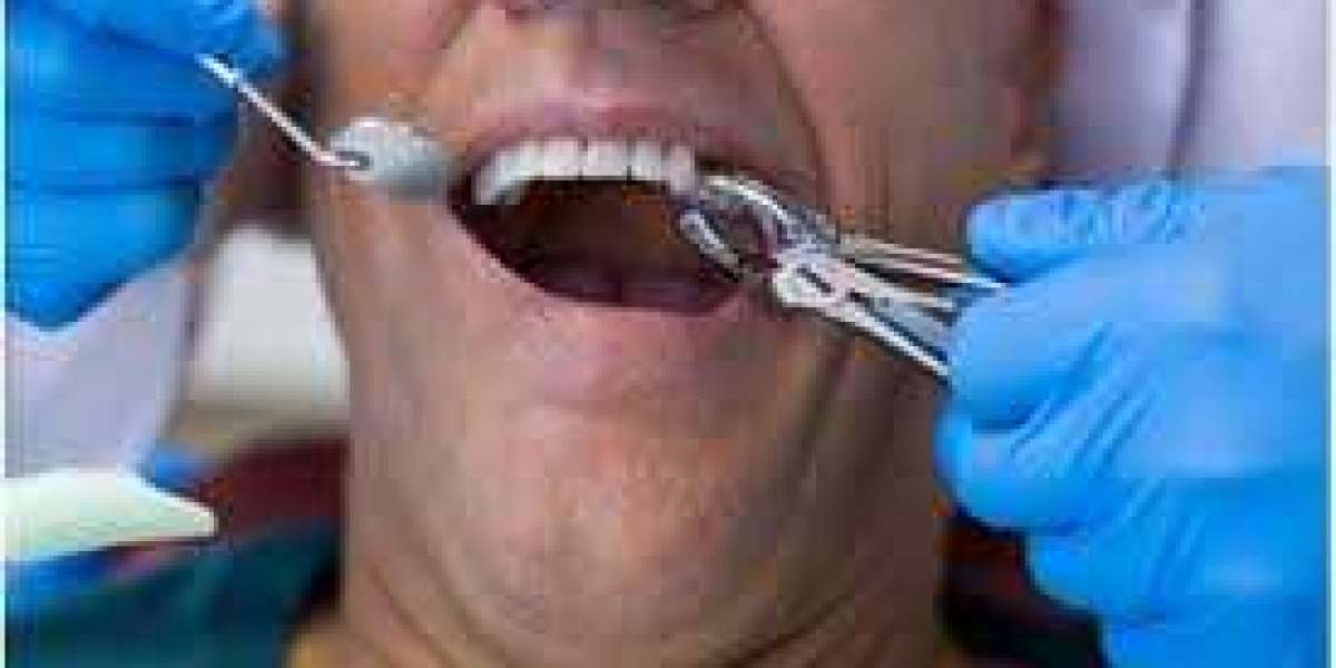 How to Quickly Relieve Tooth Extraction Pain After Emergency Surgery