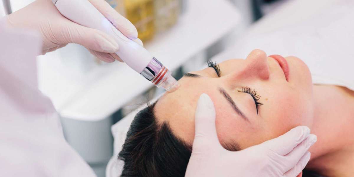 HydraFacial Treatment for Uneven Skin Texture