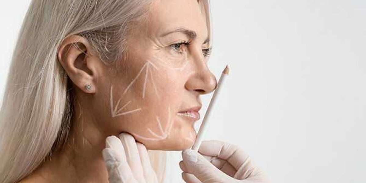 How to Protect Your Skin After Facelift Surgery